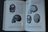 PIVETEAU: TRAITE DE PALEONTOLOGIE - TOME VII : PRIMATE, PALEONTOLOGIE HUMAINE