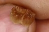 Ocepeia daouiensis - Middle Paleocene - Oued Zem, MOROCCO