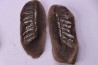 set of 5 nodules pennsylvanian (carboniferous) Carbondale Fmt - Mazon creek - Illinois - USA
