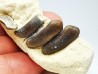 Anomoeodus (Pycnodont), Late Cretaceous,  Eben-Emael, Belgium